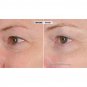 Nassif MD Peri-Orbital Complex Revitalizing Eye Cream With Elasta-Derm C & AHA.