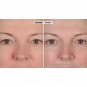Nassif MD Peri-Orbital Complex Revitalizing Eye Cream With Elasta-Derm C & AHA.