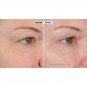 Nassif MD Peri-Orbital Complex Revitalizing Eye Cream With Elasta-Derm C & AHA.