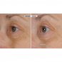 Nassif MD Peri-Orbital Complex Revitalizing Eye Cream With Elasta-Derm C & AHA.