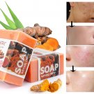 Tumeric Soap Ginger Anti-Acne Dark Spots Removal Skin Glow, Brighter Skin US