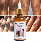 Strong Whitening Dark Skin Knuckles Feets Knees Elbows Armpit inner Thigh Serum