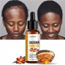 Lewedo Naturals Batana Oil Fast Hair Growth for Men Women Pure Batana Oil Nourish Shiny Hair