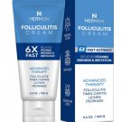 Folliculitis cream for scalp, face, and body, soothing and effective treatment. Folliculitis cream for scalp, face, and body, soothing and effective treatment.