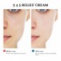 345 Relief Cream Address Blemishes Nourish The Skin and Provide Soothing Care