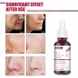 30ml Salicylic Acid Shrink Pores Serum Moisturizing Nourishing Smooth skin