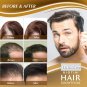 Biotin Hair Thickening Serum For Hair Growth And Volume Hair Loss Preventio