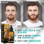 Biotin Hair Thickening Serum For Hair Growth And Volume Hair Loss Preventio