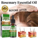 Rosemary Essentiall Oil Hair Growth Products Organic Products Scalp Hair