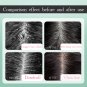 Scalp Cleansing Scrub Remove Dandruff Oil Follicle Treatment Roots Moisturizing
