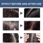 Scalp Cleansing Scrub Remove Dandruff Oil Follicle Treatment Roots Moisturizing