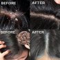 Scalp Cleansing Scrub Remove Dandruff Oil Follicle Treatment Roots Moisturizing