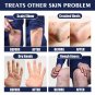 Anti-crack Hand Care Cream Dry Cracked Hands Moisturizing Not-greasy Care