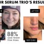 Retinol Serum Anti Wrinkle Fade Dark Spots Vitamin C Facial Serum Whiten Face Skincare