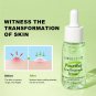 AUQUEST Salicylic Acid Acne Treatment Face Serum Pimple Remover Oil
