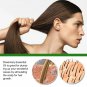 Hair Growth Spray Ginger Massage Scalp Damaged Treatment Solution Nourish