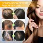 Biotin Fast Hair Growth Products Anti Hair Loss Serum Spray Prevent Baldness