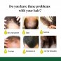Ginger Care Hair Spray Hair Growth Essence Nourish Hair Roots Massag Scalp