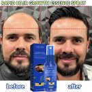 Ginger Hair Growth Serum Spray Anti Loss Regrowth Hair Growth Oil