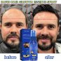 Ginger Hair Growth Serum Spray Anti Loss Regrowth Hair Growth Oil