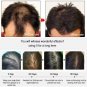 Fast Hair Growth Serum Spray Anti Hair Loss Prevent Baldness Scalp Treatment