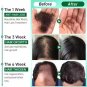 Fast Hair Growth Serum Spray Anti Hair Loss Prevent Baldness Scalp Treatment