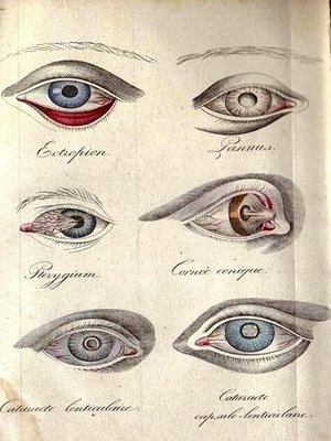 Traite Pratique sur les Maladies des Yeux, Contenant L'Anatomie, la Physologi