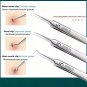 3-Piece Blackhead & Blemish Removal Tool Set â Stainless Steel Pore Care