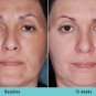 KOJIC ACID Skin Whitening Lightening Ultra Brightening Serum Dark Spot Cream