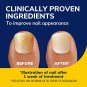 Dr Scholls Fungal Nail Revitalizer Light Therapy Treatment Kit 033 fl oz 10ml