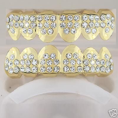 Forty-eight points of ice gold plated playa top and bottom grillz set