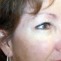 EpiLift Instant Face Lift Serum - 3 Month Supply
