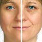EpiLift Instant Face Lift Serum - 2 Month Supply