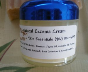 Eczema and Psoriasis Balm