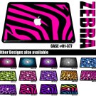 #01-377 Hard Case skin For Apple MacBook Pro 13" 13.3" A1278