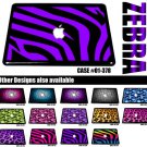 #01-378 Hard Case skin For Apple MacBook Pro 13" 13.3" A1278